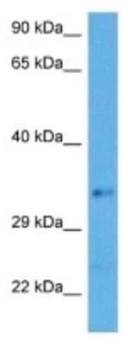 COMMD3-BMI1 Rabbit anti-Human, Polyclonal, Novus Biologicals 100 &mu;g;